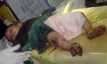 baby-injured-by-nato.jpg