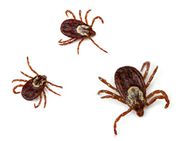 Tick-audioprothesiste-perte-auditive-audioprothese-oreille.jpg