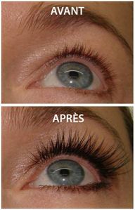 extension.cils.jpg