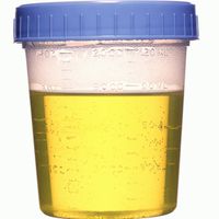 urine-pot.jpg
