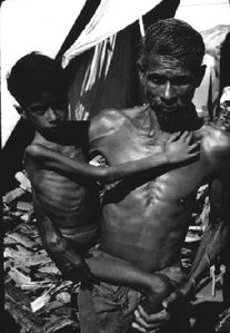 Starved child
