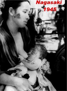 1945 mere et son enfant irradies Nagasaki