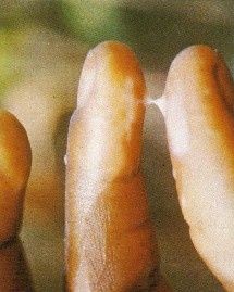 Analyse de la glaire cervicale ou méthode Billings - Le Analyse de la glaire cervicale ou méthode Billings - Le