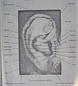 Auriculotherapie-011.JPG