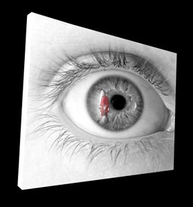 Mon oeil
