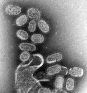 EM of influenza virus 02