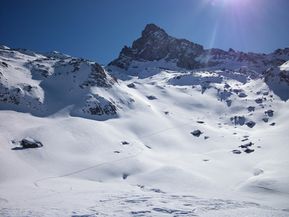 100 0952 tète des toillies