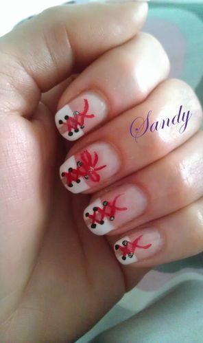 Base Gel