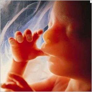 foetus_bebe.JPG