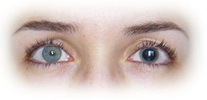 operation yeux