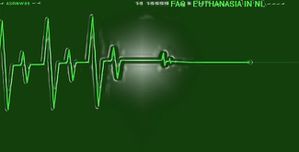 electrocardiogramme-plat.jpg