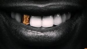dent%20en%20or%203