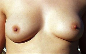 Weibliche-brust (1)