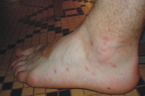 Comme traiter les parasites chez le chat
