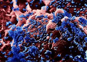 Photo-virus-H5N1-BIS.jpg