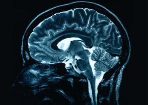 radio_cerveau.jpg