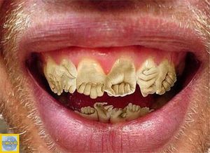 dents-sculptes.jpg