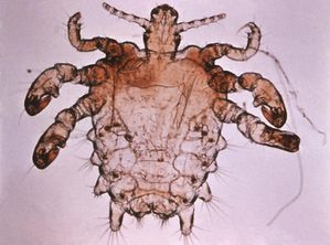 piattola-pidocchio-pube.jpg