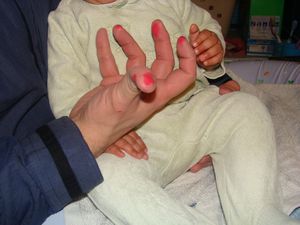 fessier-irrite-6.JPG