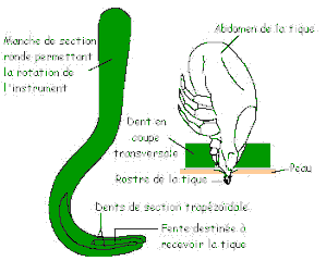 Lhuile pour la personne le nettoyant