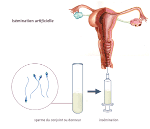 insemination-artificielle-o.gif