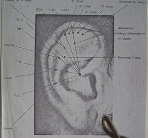 Auriculotherapie-010.JPG