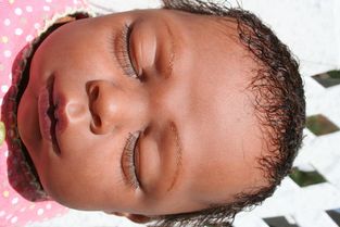 Pourquoi tombent les cheveux chez les enfants klokami