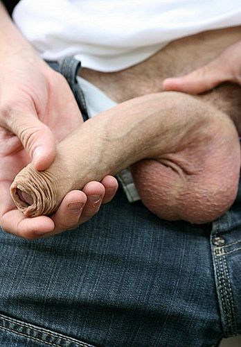 Les crèmes lécorce contre la pigmentation
