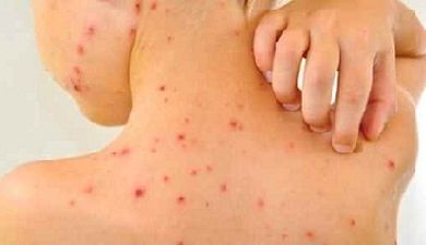 I posti spremuti una faccia rossa come si libererà da rosso