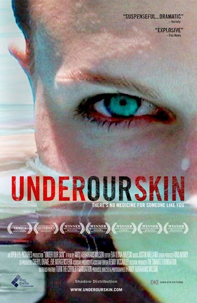 Under-Our-Skin.jpg