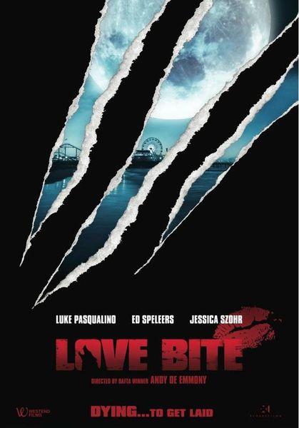 Love-Bite.jpg