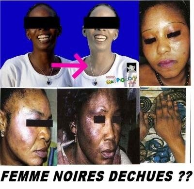 La crème blanchissant bolgariya les rappels