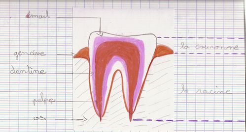 dents.jpg