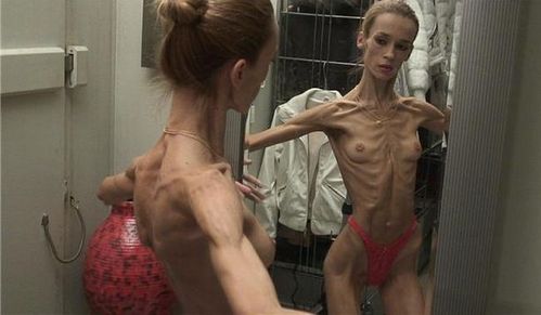 anorexia_07.jpg