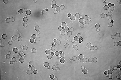 Saccharomyces cerevisiae