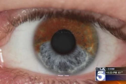 La gymnastique des oedèmes sous les yeux de vidéo