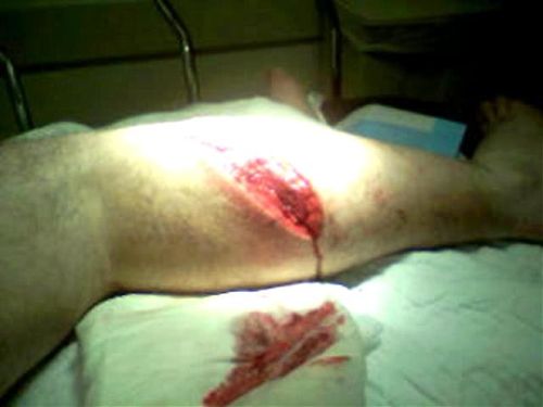 accident par helico (2)