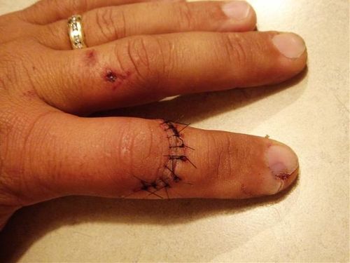 accident par helico (5)