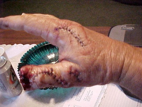 ouch