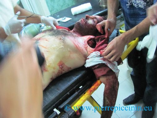SYRIE--Alep----Juillet-et-aout-2012 1798 - Copie