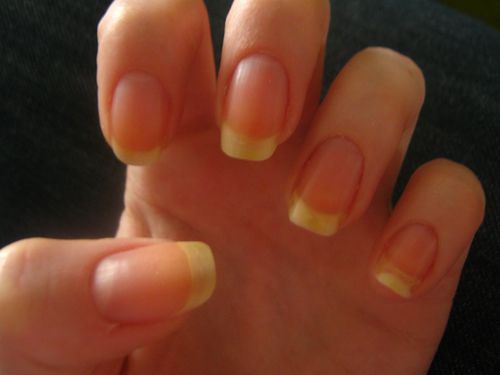 ongles 1108