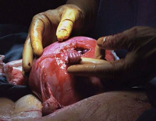 La toute petite main d'un foetus