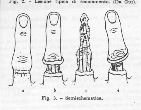 Les adaptations pour laugmentation penisa