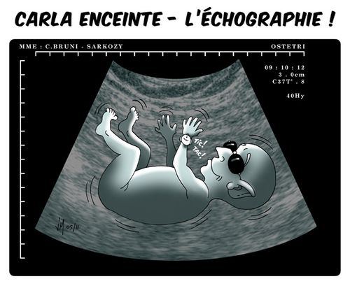 carla-enceinte-echo.jpg