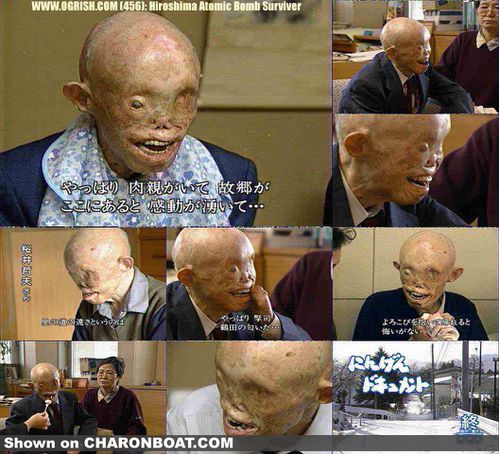 hiroshima_victim-survivor.jpg