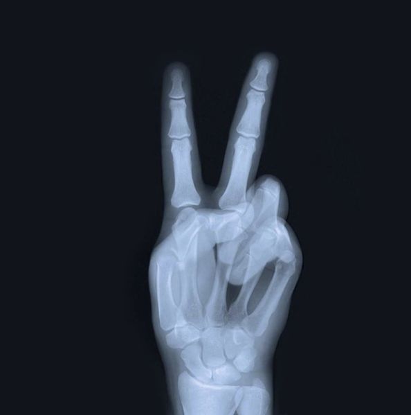 Radiographie-Victoire.jpg