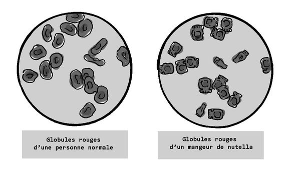 globules nutella001