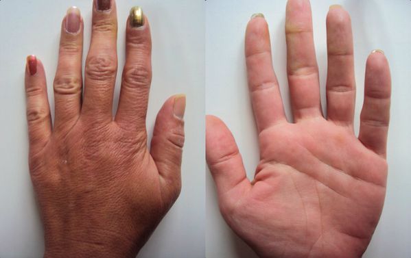hand8.jpg