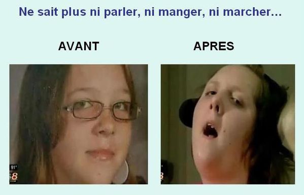 Victime Gardasil 1b