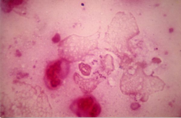 Calymmatobacterium granulomatis